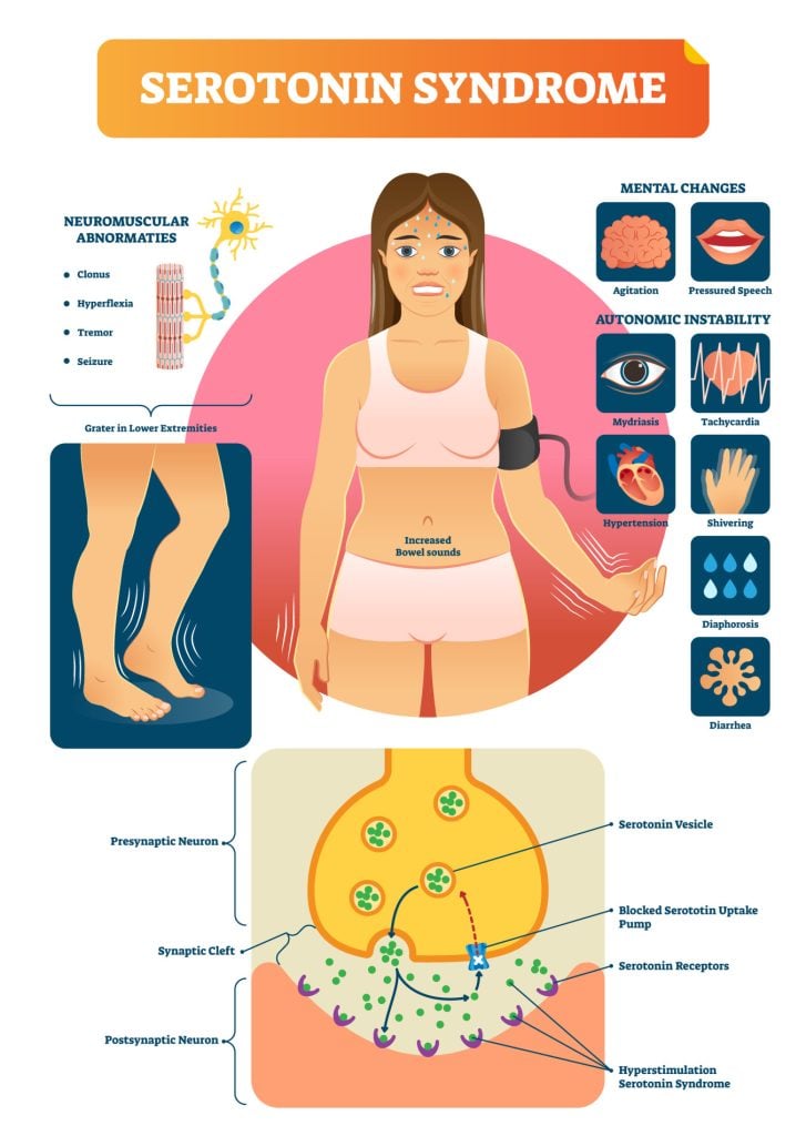 Serotonin syndrome